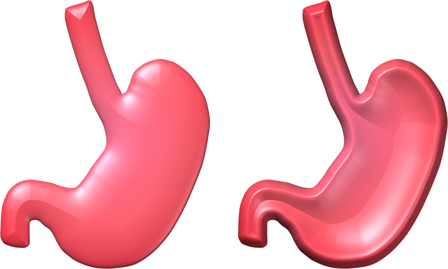 Cara Redakan Perut Kembung