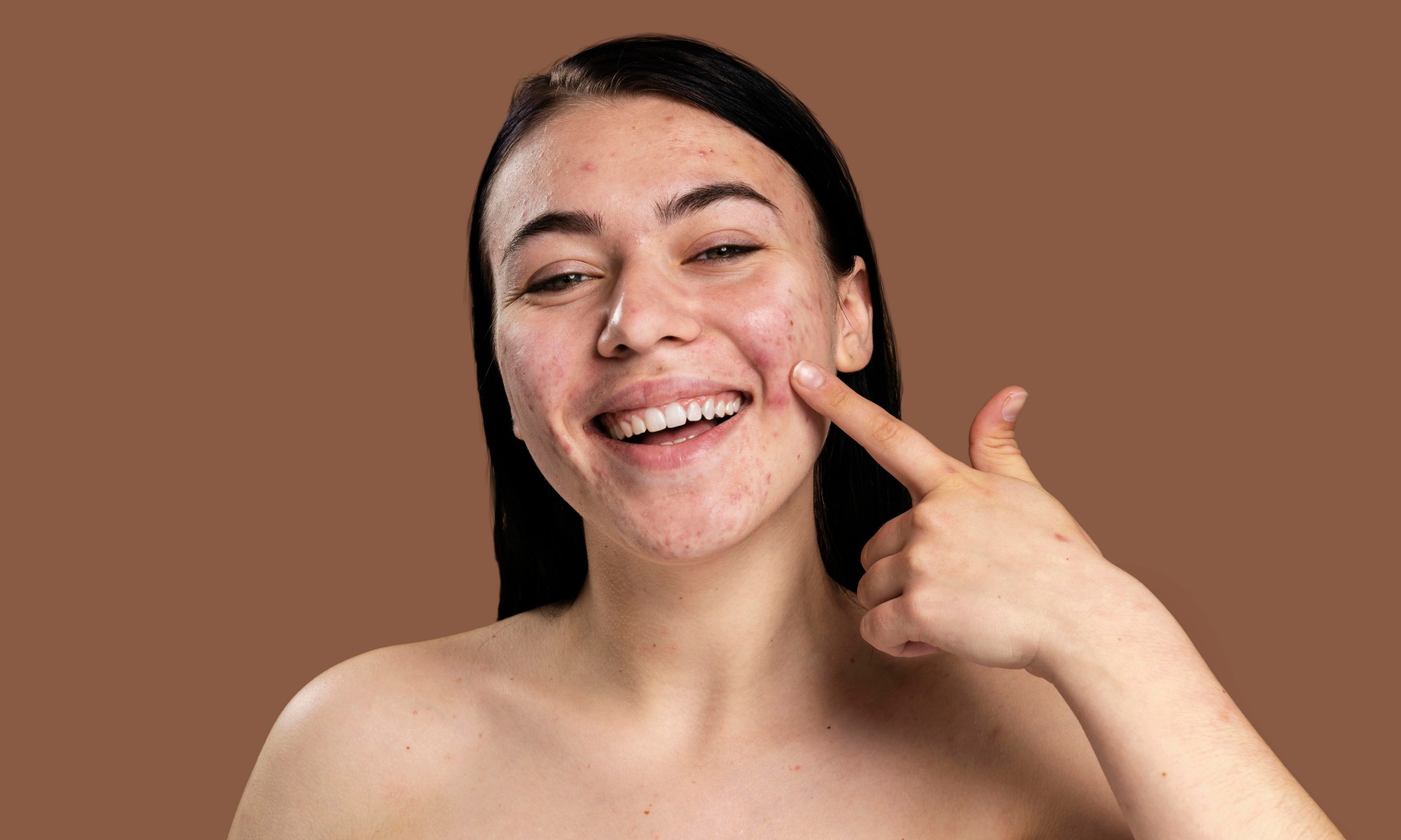 Kenali Tanda Kerusakan Kulit Akibat Steroid Dalam Skincare