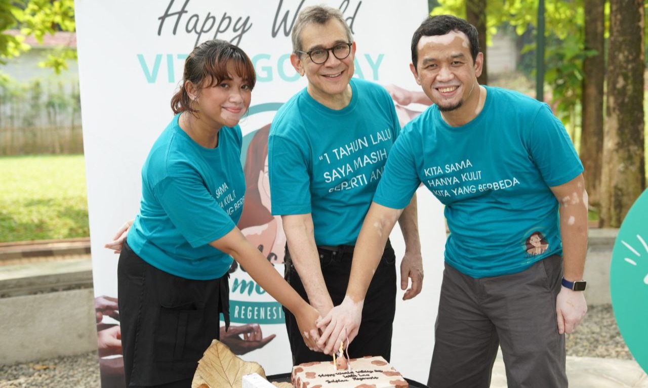 Lawan Diskriminasi Vitiligo Dengan Selflove Movement