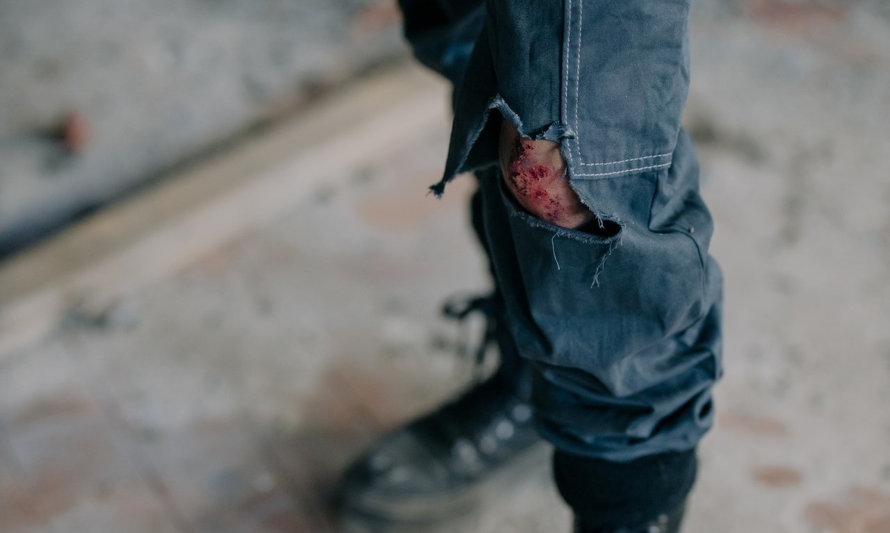 Pentingnya Selalu Sedia Antiseptik Povidone Iodine Di Rumah