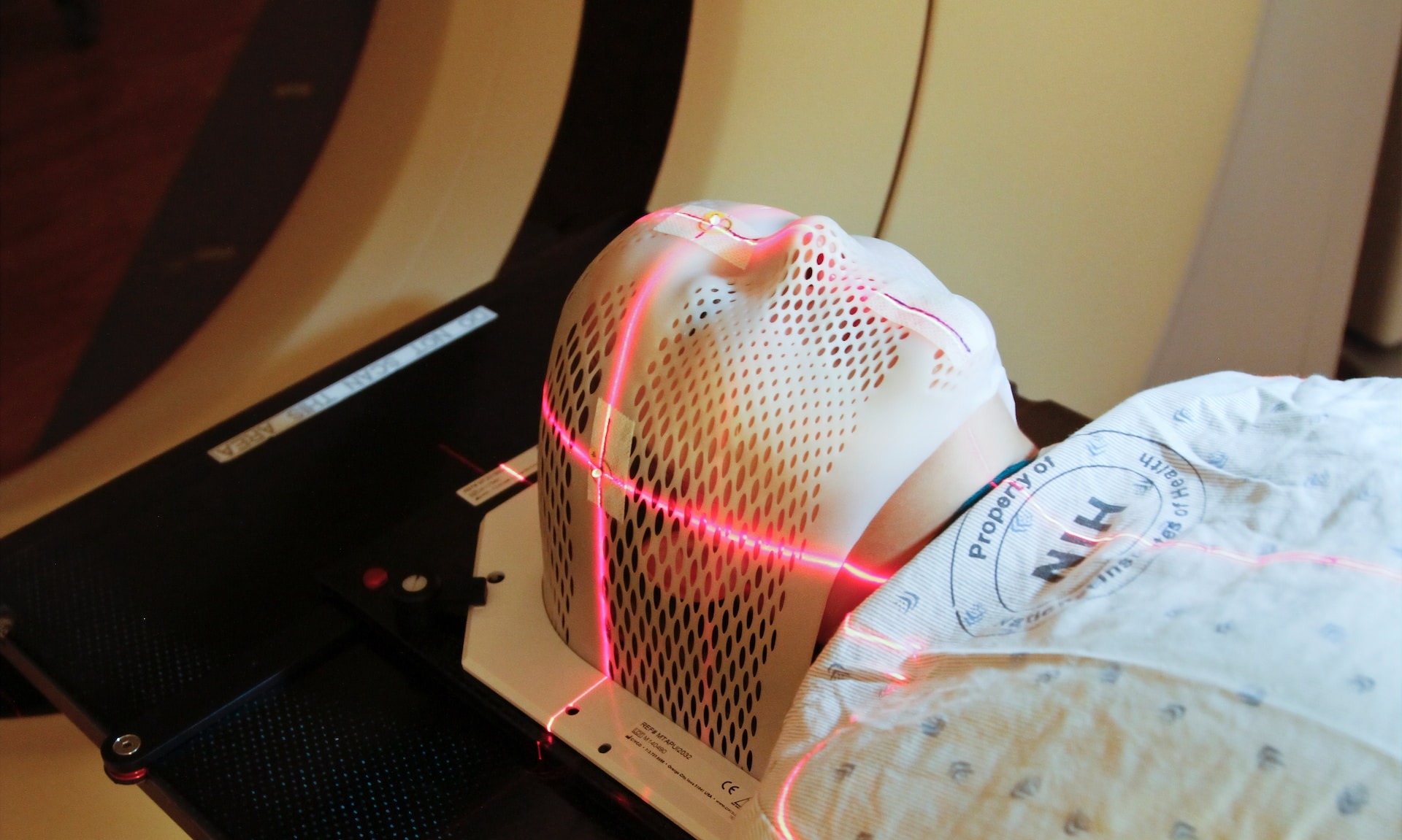 Bahaya Di Balik Aneurisma Otak Yang Bisa Sebabkan Disabilitas