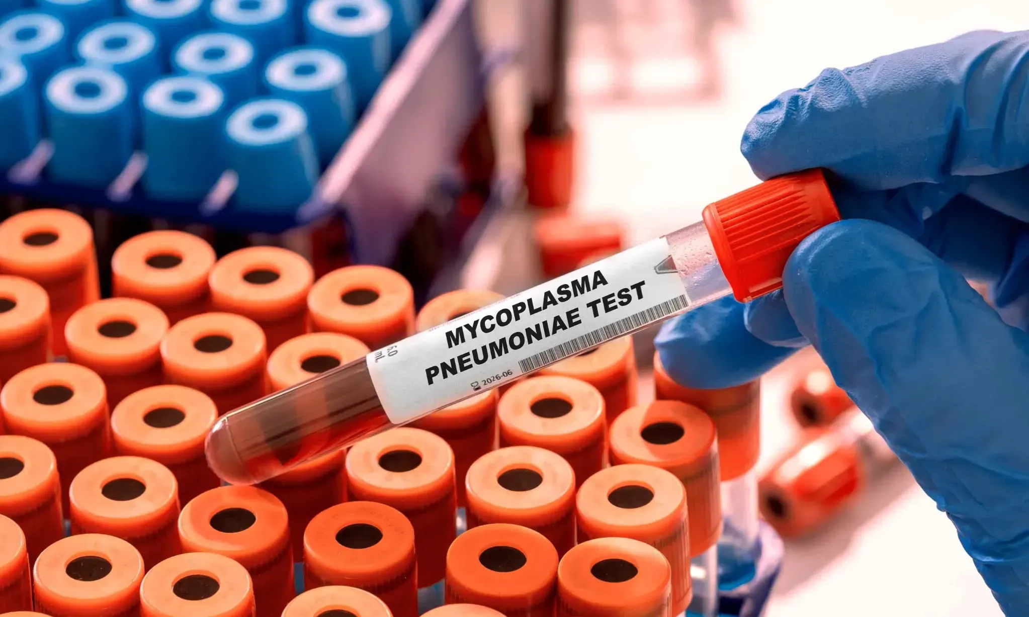 Tak Usah Khawatir, Mycroplasma Pneumonia Tak Separah Covid-19