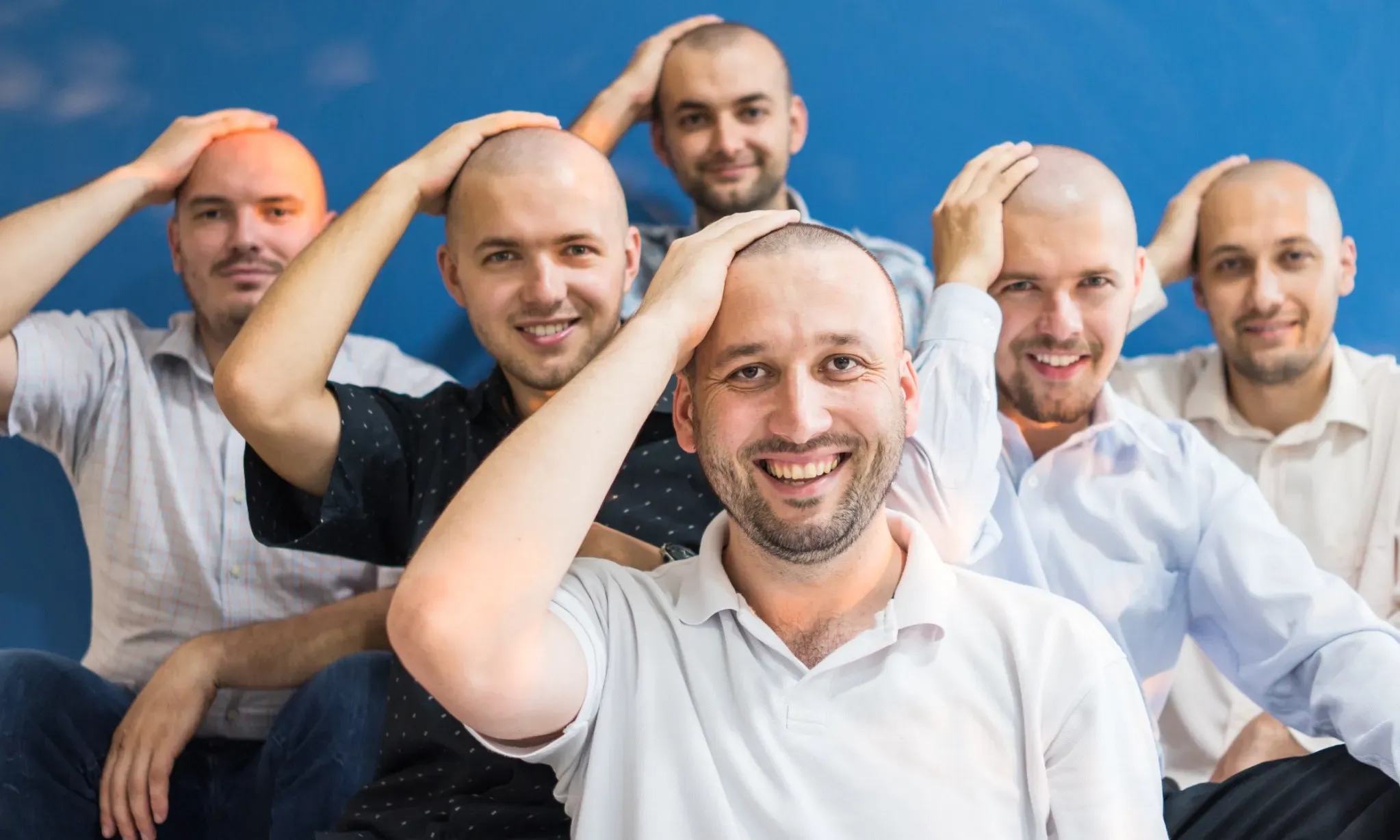 Guru Besar UI Buat Terobosan Atasi Kebotakan Rambut