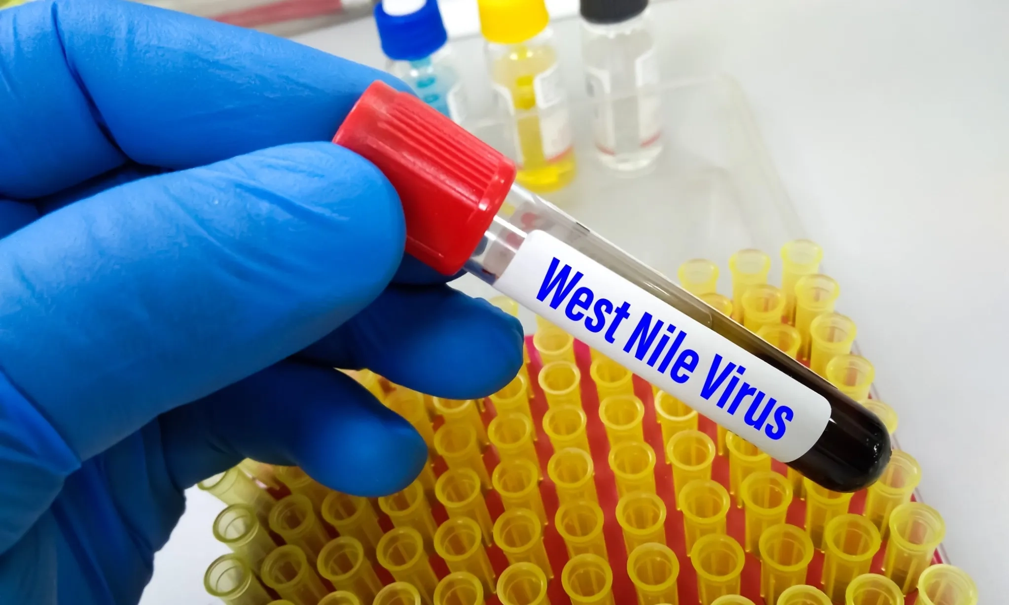 <p>Virus West Nile; Kenali Gejala Dan Bagaimana Penularannya</p>