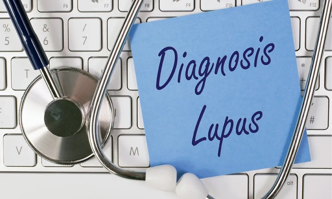 <p id="isPasted">Kemenkes Ungkap Tantangan Pengendalian Lupus</p>