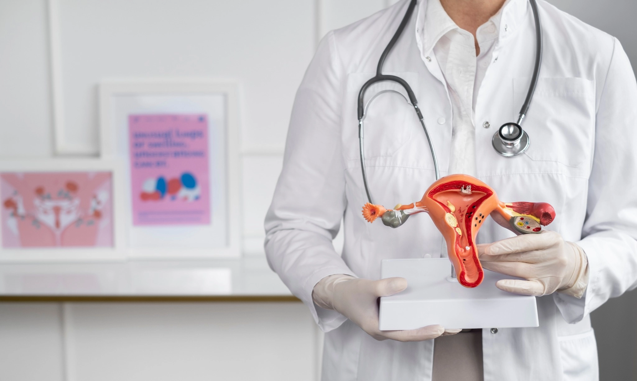 <p>Diabetes Pada Remaja Perempuan Dan Risiko PCOS</p>