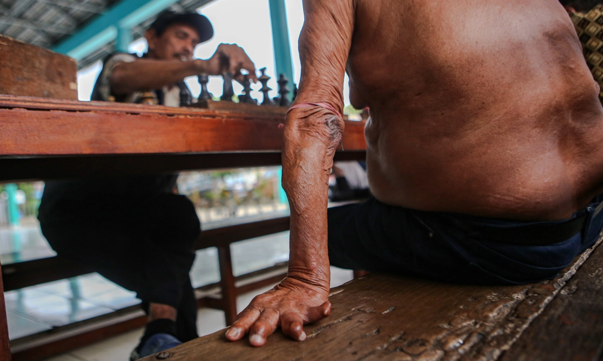 <p>Ahli Dorong Pengembangan Teknologi Medis Untuk Pengobatan Kusta</p>