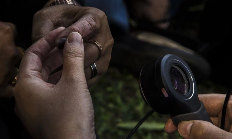 <p>Cara-Cara Menekan Gejala Penyakit Autoimun</p>