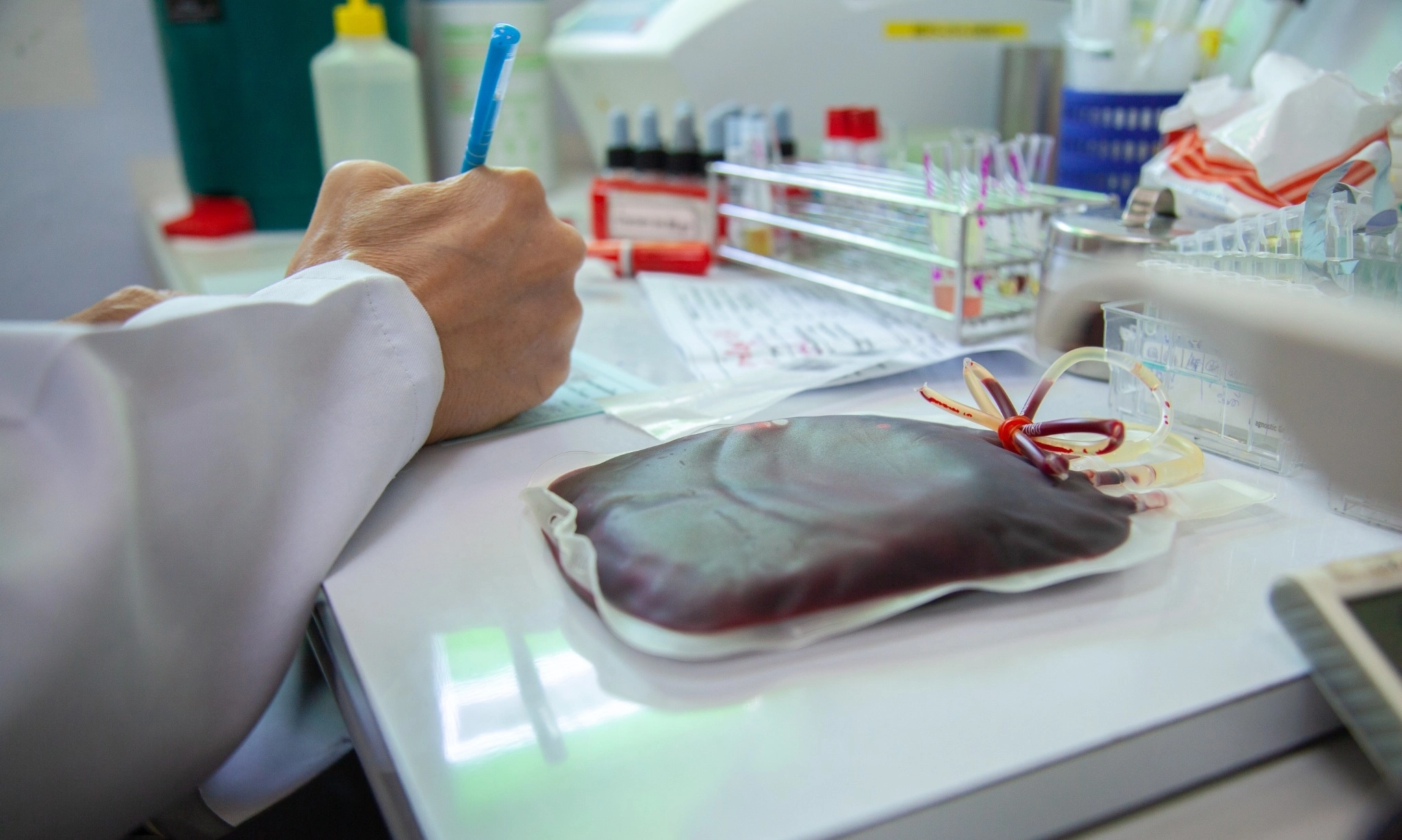 <p>Apa Itu <em>Crossmatch&nbsp;</em>Darah?</p>