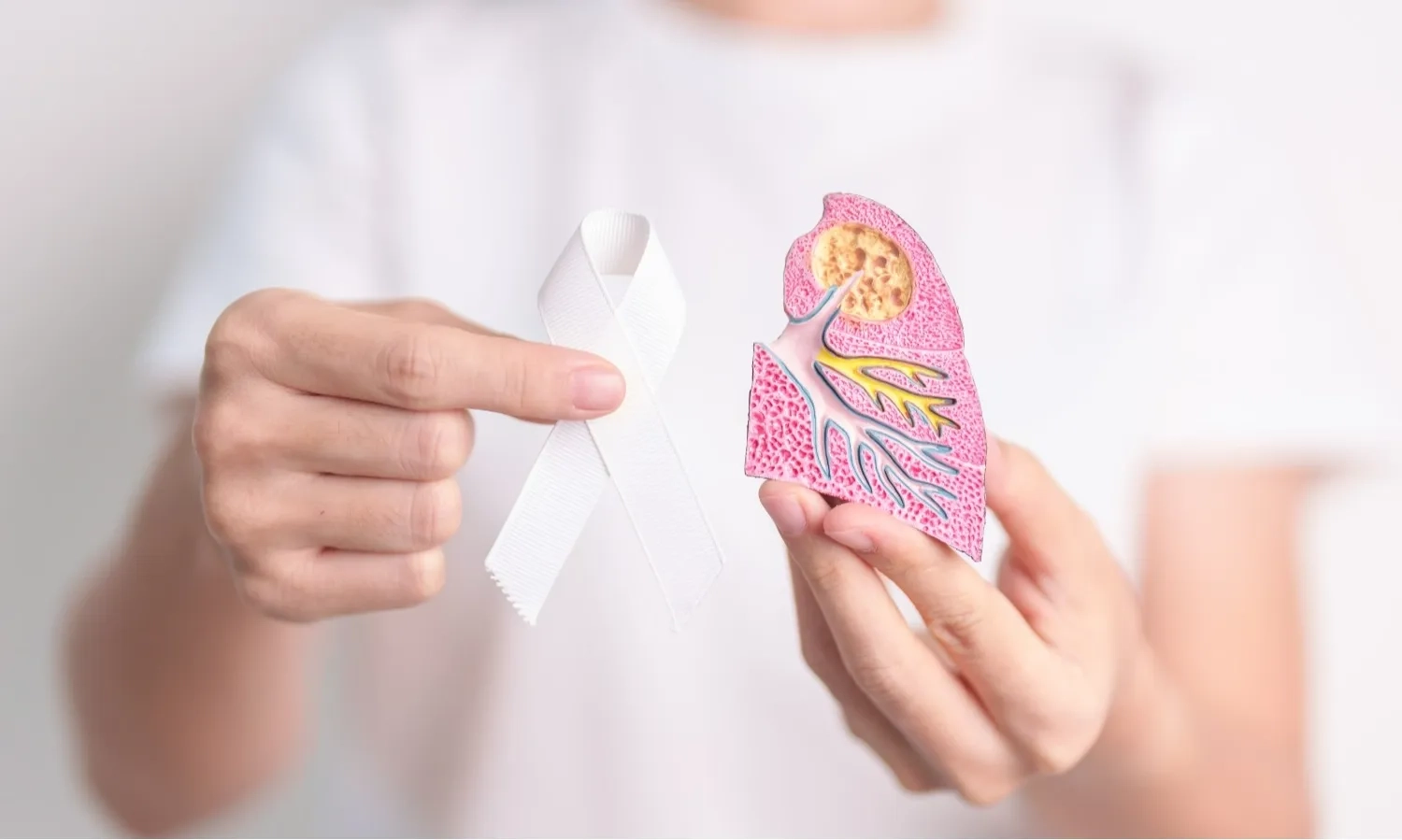 <p>Kenali Gejala Kanker Paru Yang Kerap Samar</p>