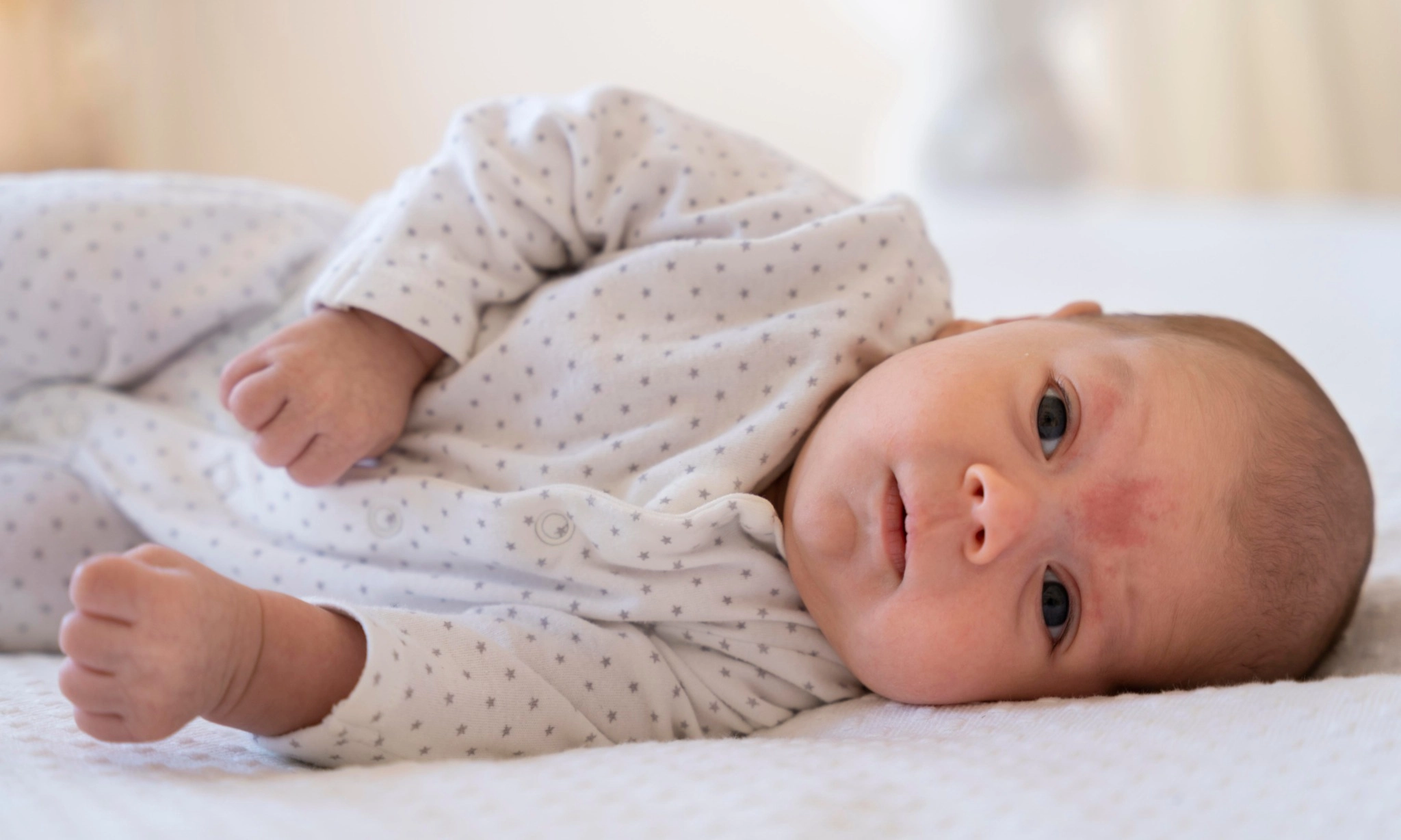 <p>Jaga Kesehatan Kulit Bayi Di Iklim Tropis Dengan Pendekatan Microbiome</p>