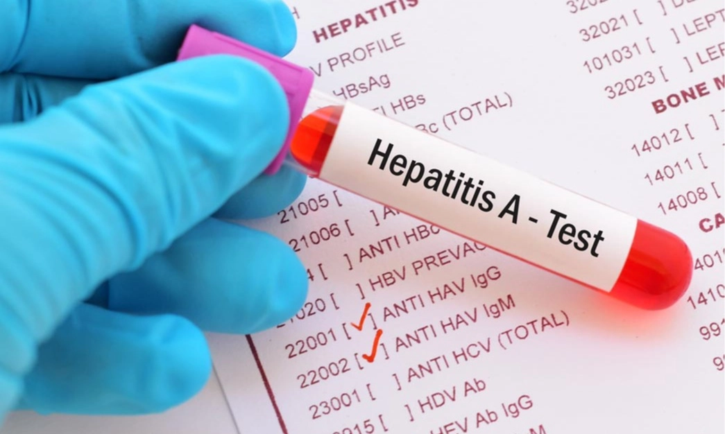 <p>Kemenkes Ungkap 3 Cara Penanganan Hepatitis</p>