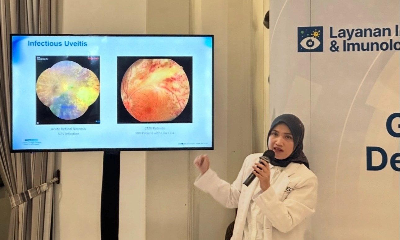 <p>Langkah Tepat Menangani Uveitis Sebelum Merusak Penglihatan</p>