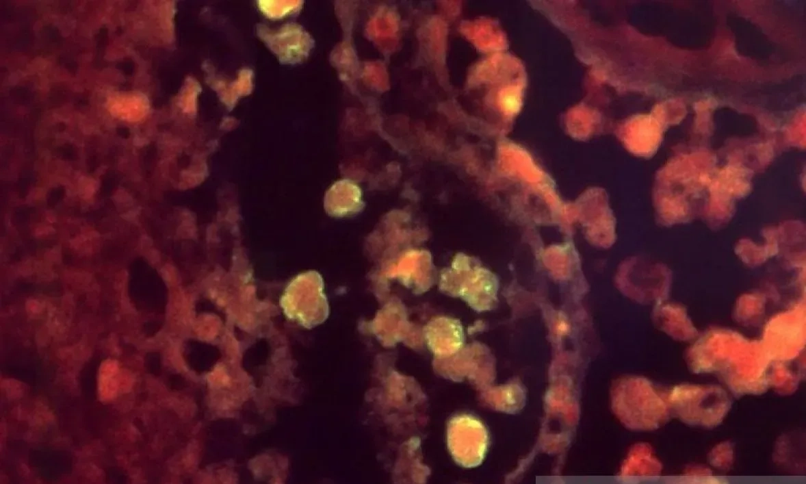 <p id="isPasted">Bagini Cara Amuba Masuk Dan Menginfeksi Otak Manusia</p>