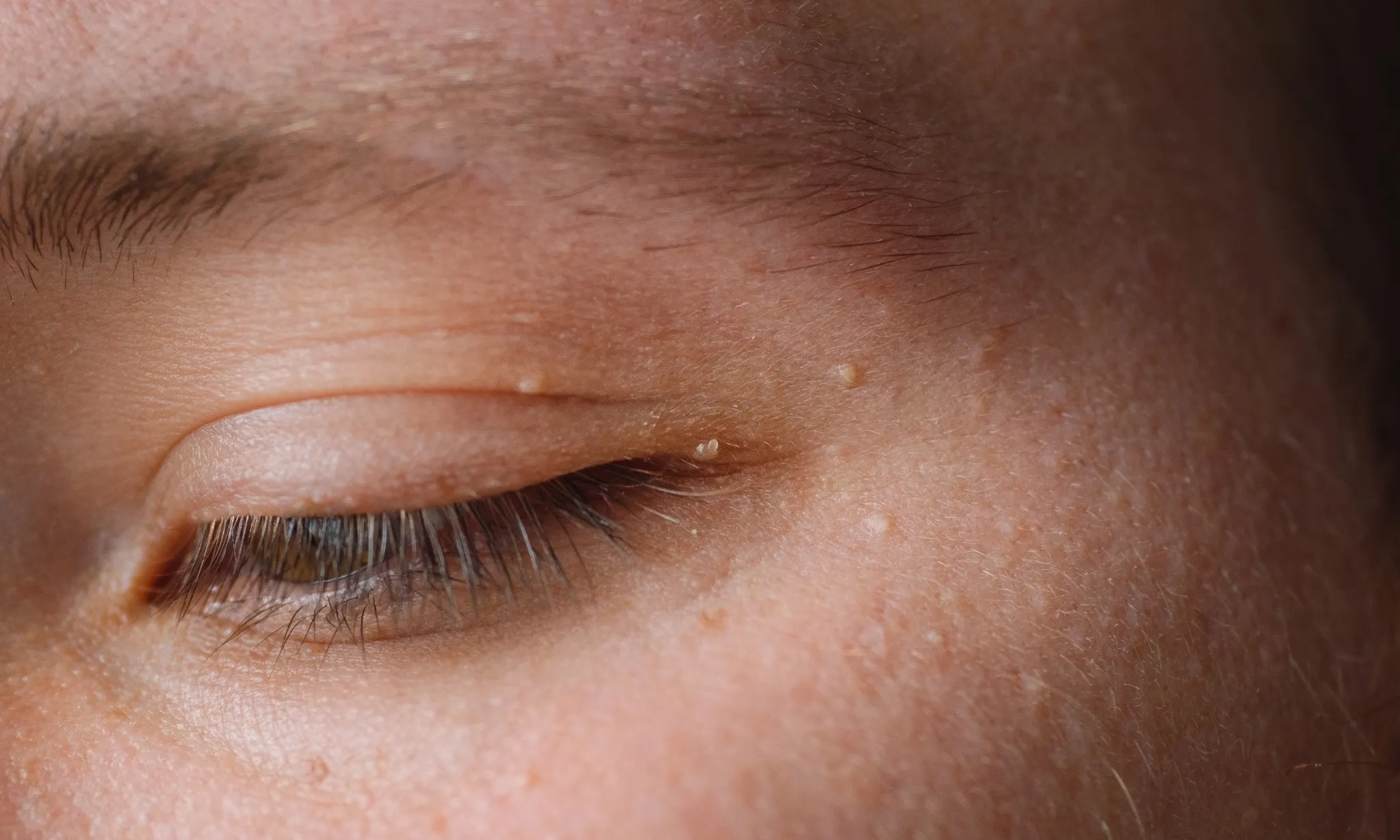 <p id="isPasted">Jangan Keliru, Ini Beda Bintik Penuan Dan Kanker Kulit Melanoma</p>