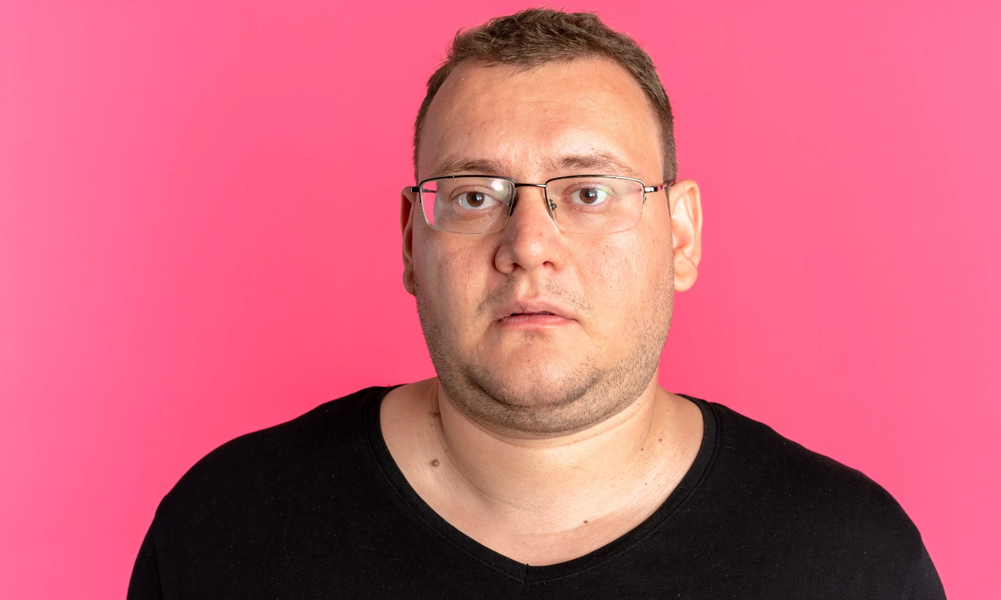 <p id="isPasted">Mengenal Kondisi <em>Moon Face</em>, Saat Wajah Membulat Seperti Bulan</p>