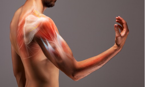 Perbedaan <i>Spinal Muscular Atrophy</i> Dan Distrofi Otot