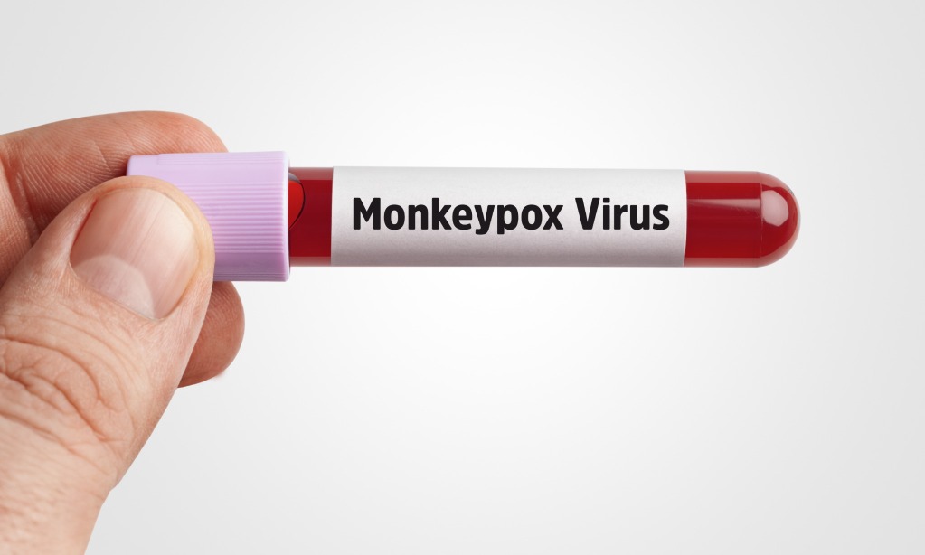 Pasien Monkeypox Di Indonesia Sembuh