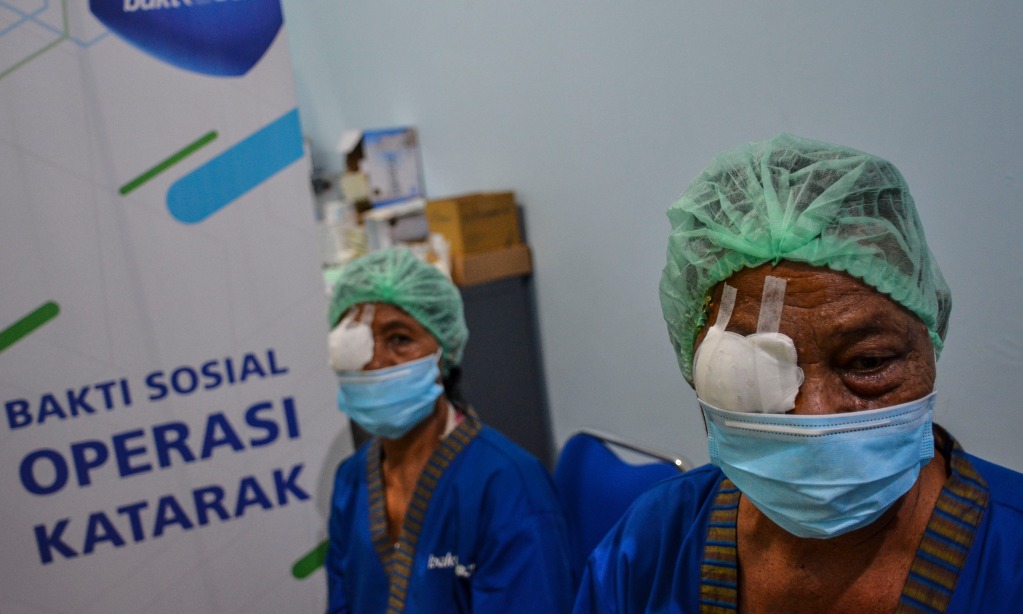 Mewaspadai Ragam Pemicu Katarak