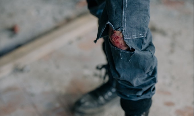 Pentingnya Selalu Sedia Antiseptik Povidone Iodine Di Rumah