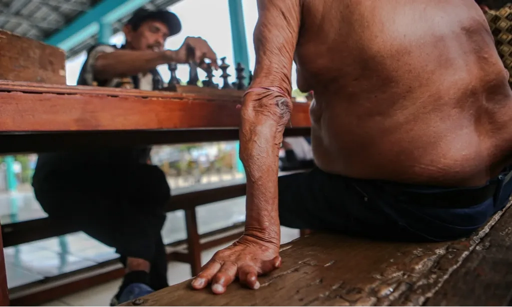 Perempuan Penyintas Kusta Alami Kerentanan Berlapis