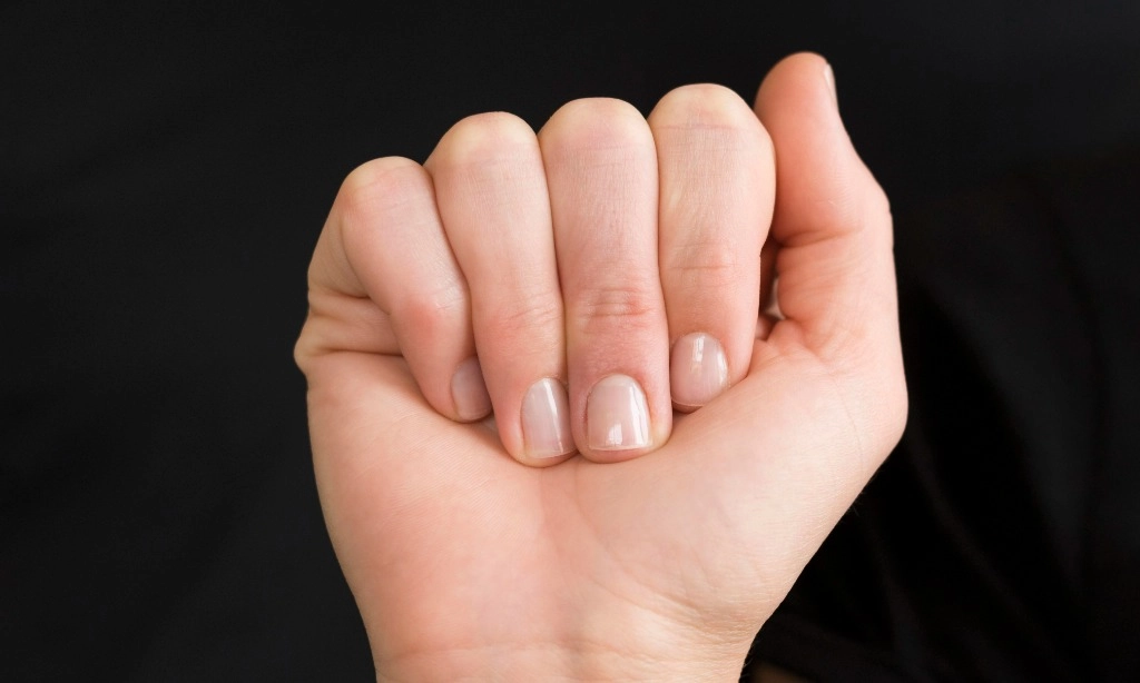 <p>Perubahan Warna Kuku Bisa Menandakan Risiko Kanker</p>