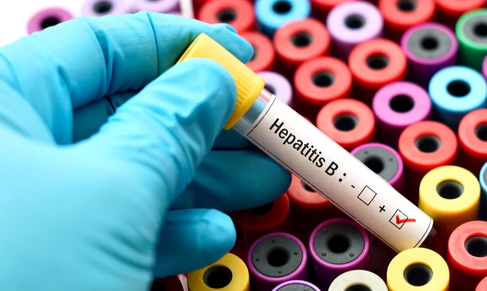 <p>Kemenkes Perkirakan Penderita Hepatitis B Capai 6,7 Juta Orang</p>