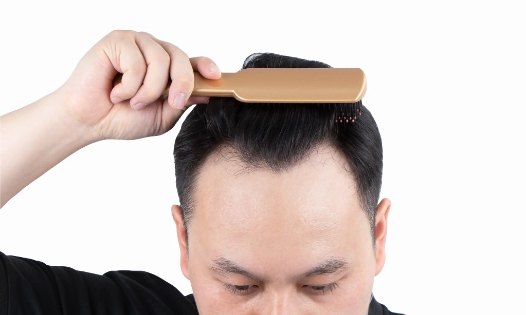 <p>Waspadai Kebotakan Dan Cara Mengatasinya</p>