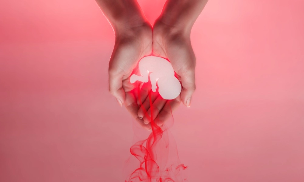 <p>IDI Ingatkan Dampak Pemerintah Legalkan Aborsi</p>