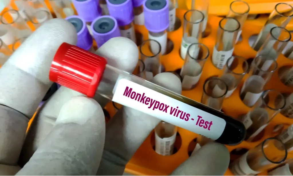 <p>Mengenal Mpox Yang Tengah Jadi Kegawatdaruratan Dari WHO </p>