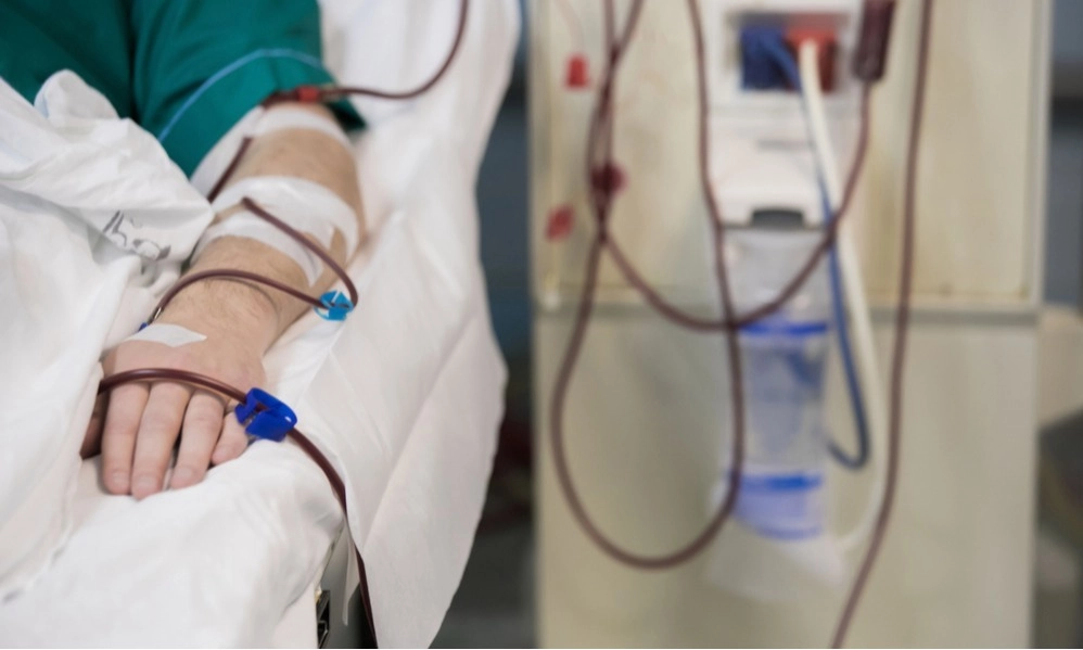 <p>Tren Hemodialisis Di Kalangan Anak Muda</p>