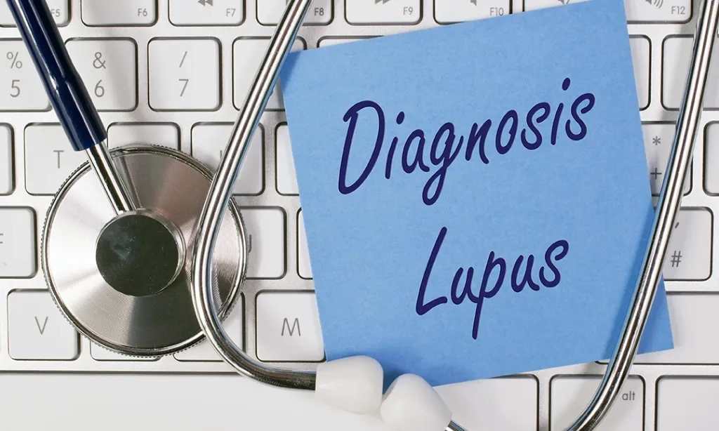 <p id="isPasted">Kemenkes Ungkap Tantangan Pengendalian Lupus</p>