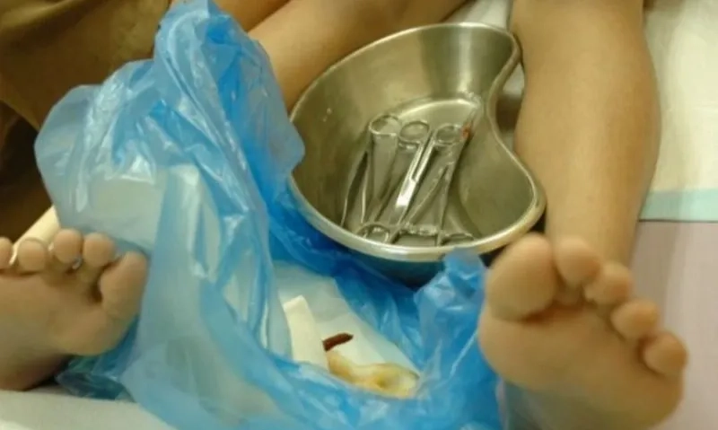 <p>KPPPA Ingatkan Perlunya Perpres Terkait Sunat Perempuan</p>