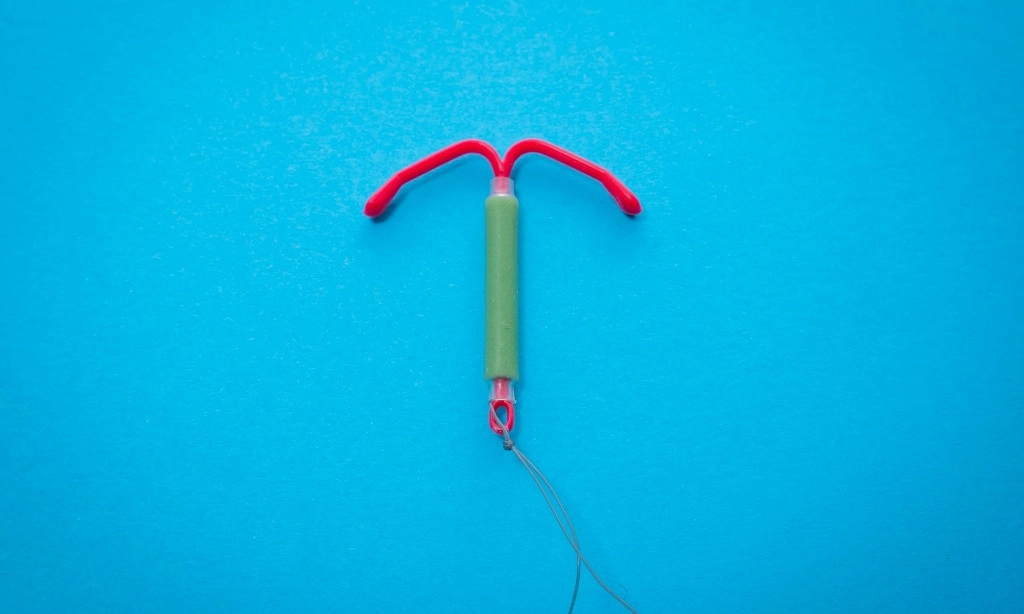 <p>Pasang IUD Bisa Percepat Kehamilan, Benarkah?</p>