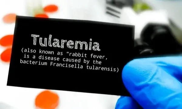 <p>Mengenal Demam Kelinci, Penyakit Yang Tengah Melonjak Di AS</p>