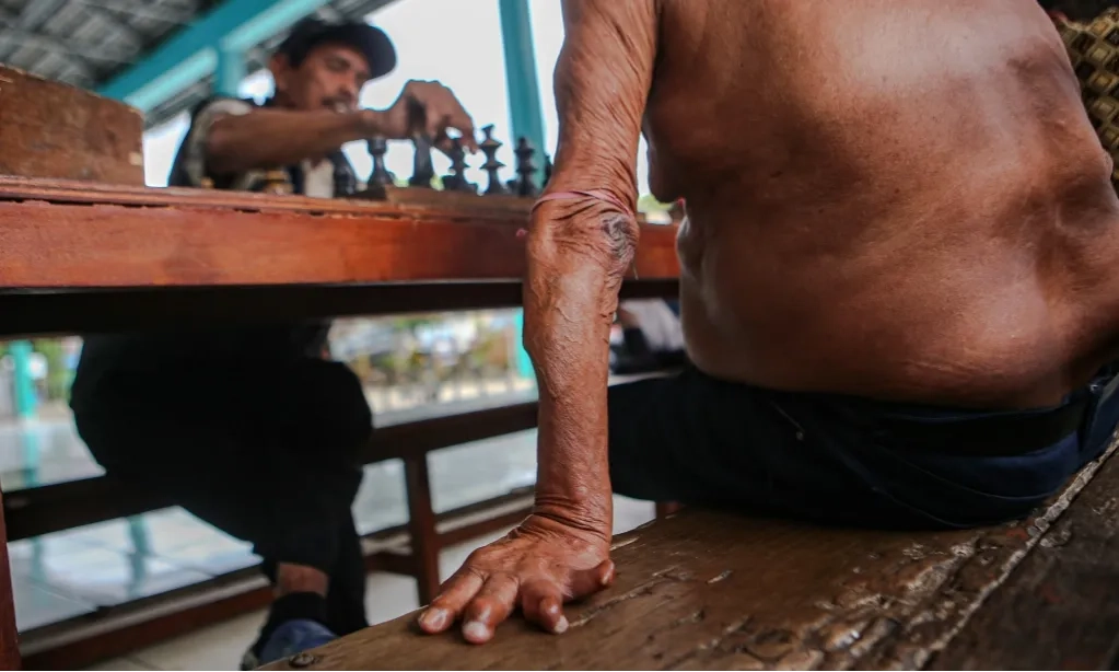 <p>Indonesia Peringkat Ketiga Negara Dengan Kasus Kusta Terbanyak</p>