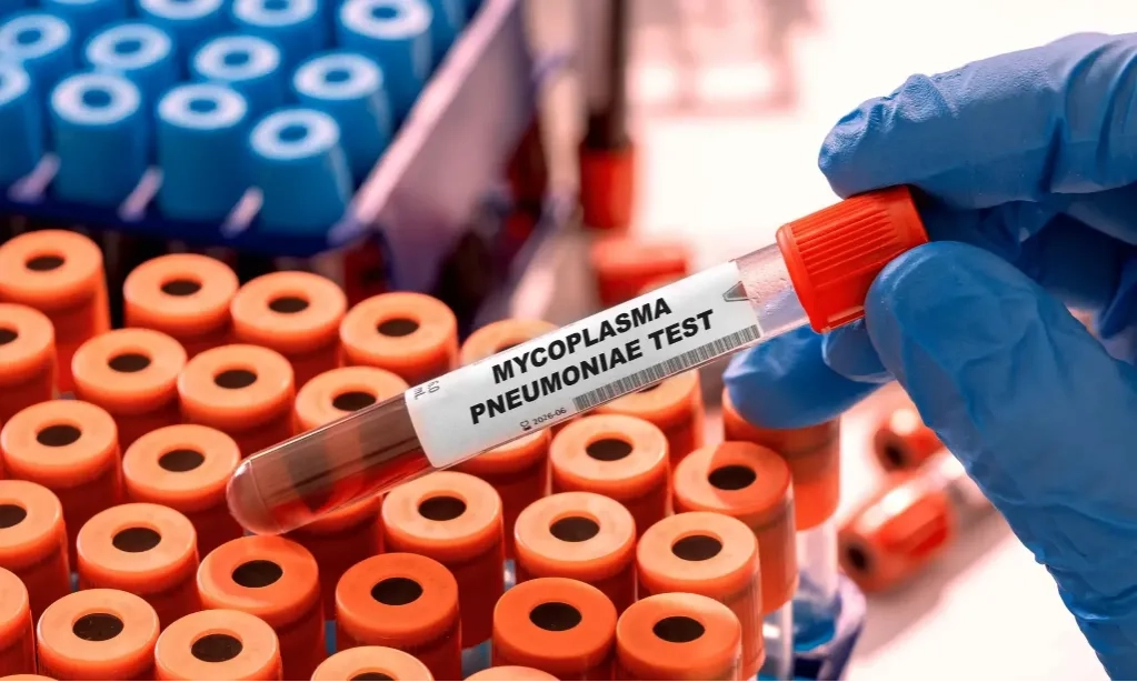 <p>Kurang Istirahat Perburuk Kondisi Pneumonia</p>