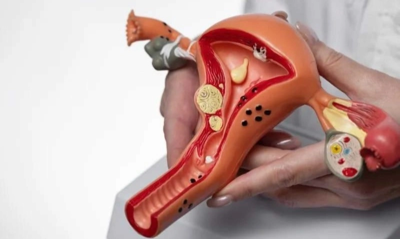 <p>Kanker Serviks Berisiko Menular Pada Anak Perempuan</p>