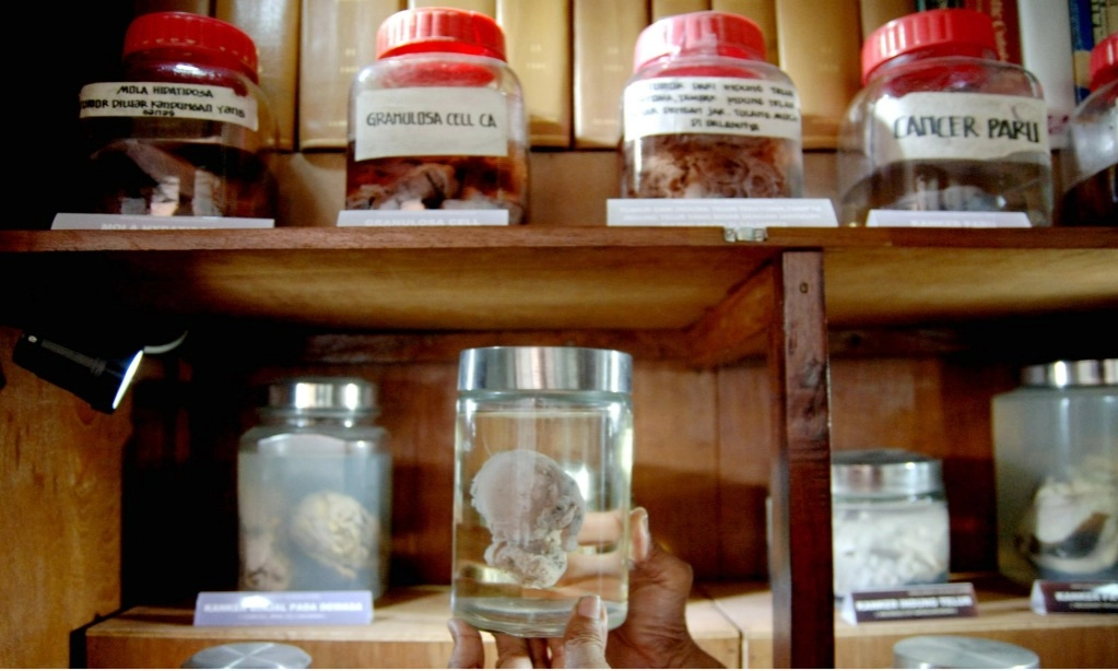 <p>Puasa Intermiten Cegah Risiko Kanker</p>