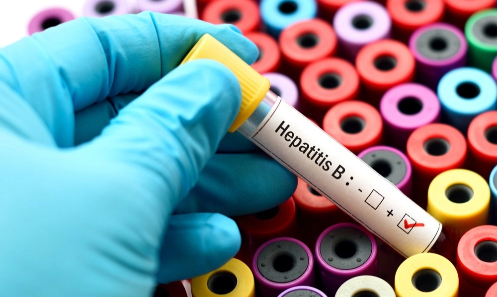 <p>Sebagian Besar Kasus Hepatitis B Pada Bayi Tidak Bergejala</p>
