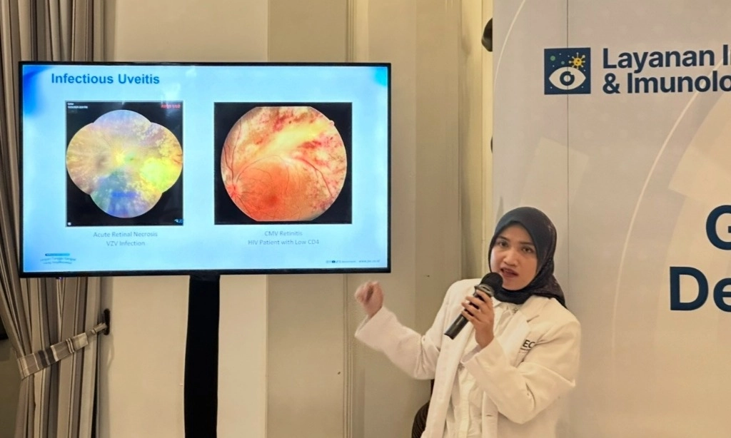 <p>Langkah Tepat Menangani Uveitis Sebelum Merusak Penglihatan</p>