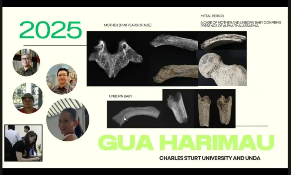 <p>Manusia Purba Gua Harimau Pernah Terjangkit Malaria Dan Thalaseemia</p>