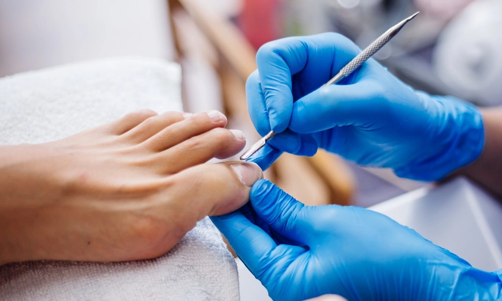 <p>Hati-hati, Penderita Diabetes Jangan Sembarangan <em>Pedicure</em></p>