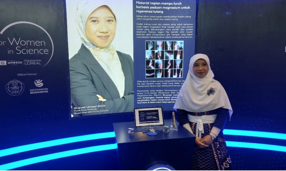 <p>Inovasi Implan Tulang Luruh Dari Material Magnesium</p>