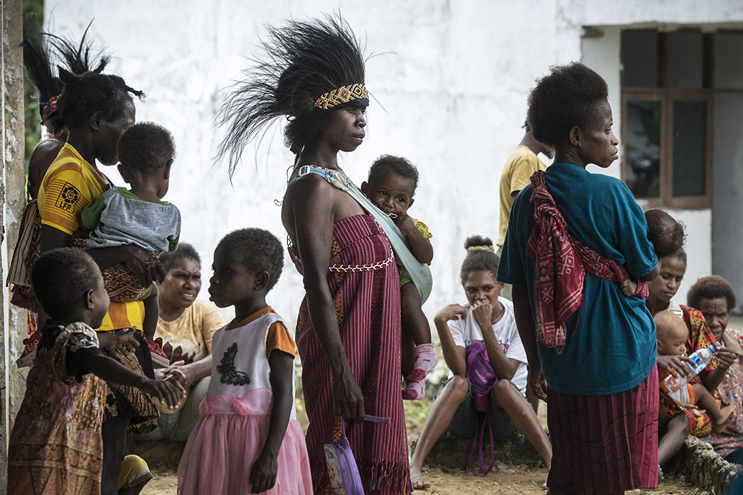 Diare-Gizi Buruk di Okbibab Papua Sebabkan 23 Balita Meninggal