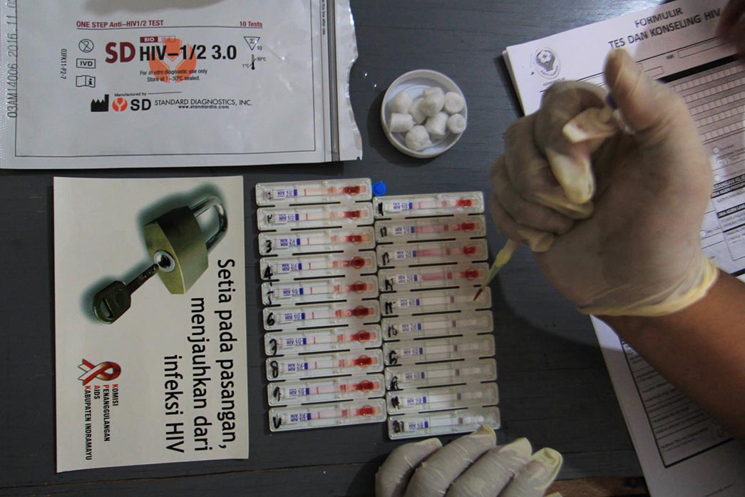 Setiap Hari 2.000 Anak Indonesia Tertular HIV