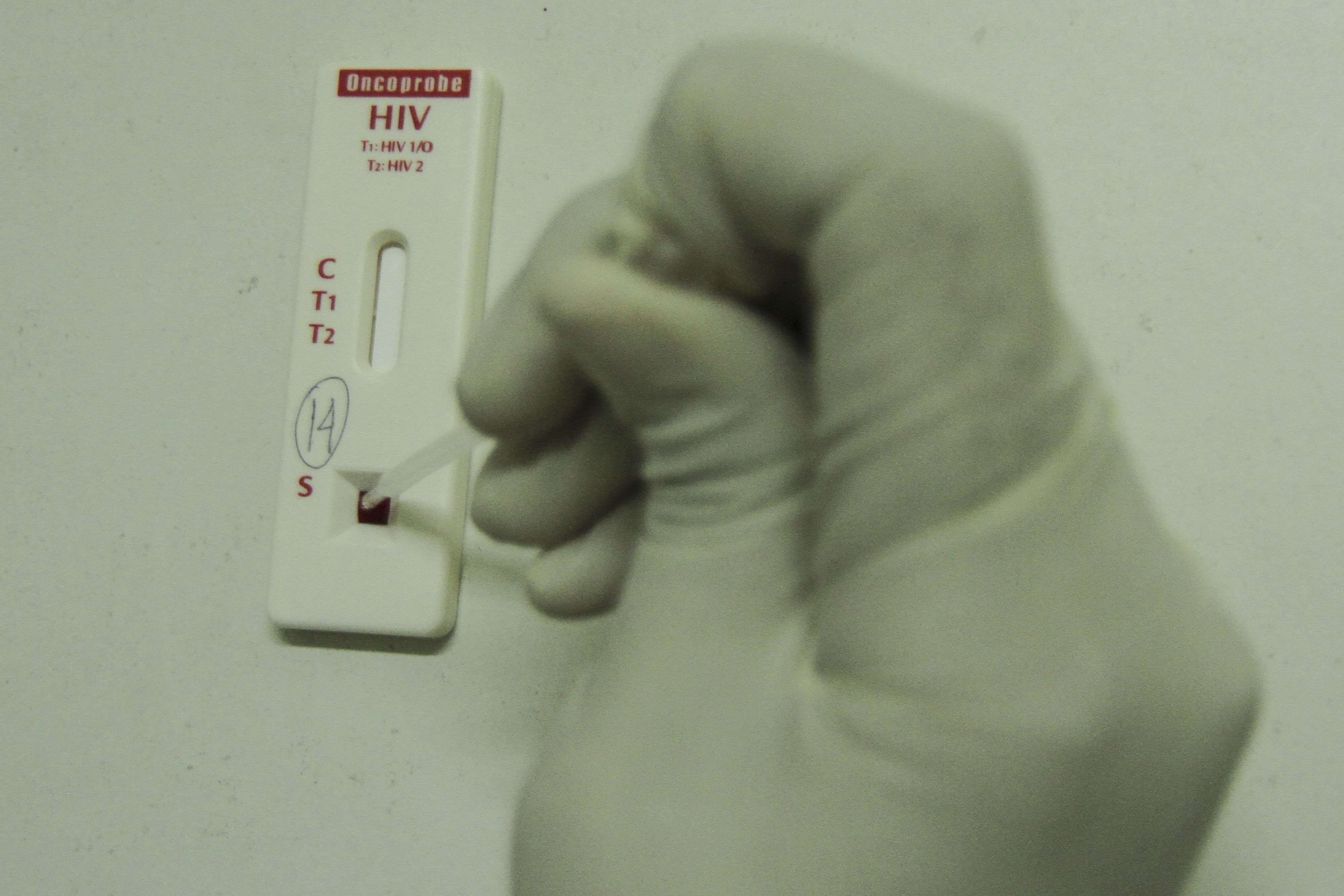 Program Pencegahan HIV Masih Minim Libatkan Masyarakat