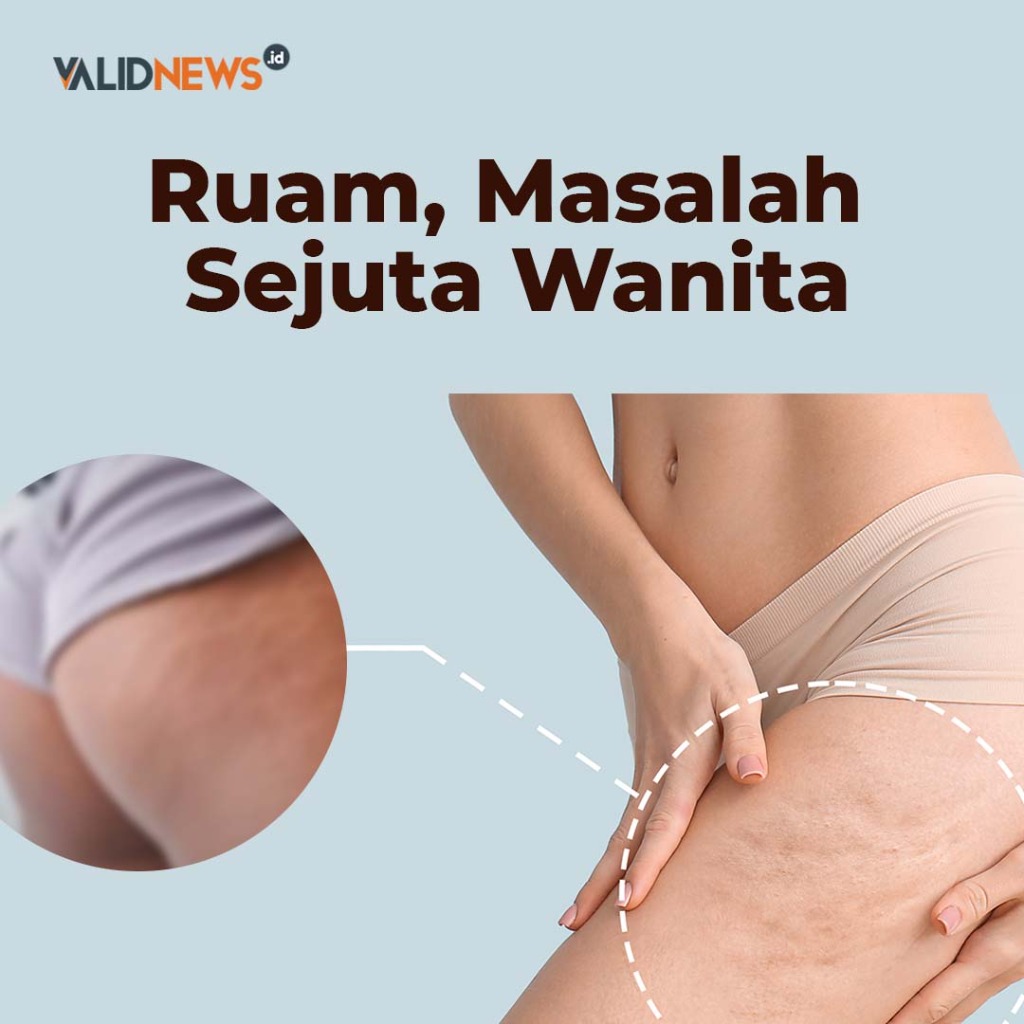 Ruam, Masalah Sejuta Wanita